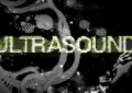 ULTRASOUND